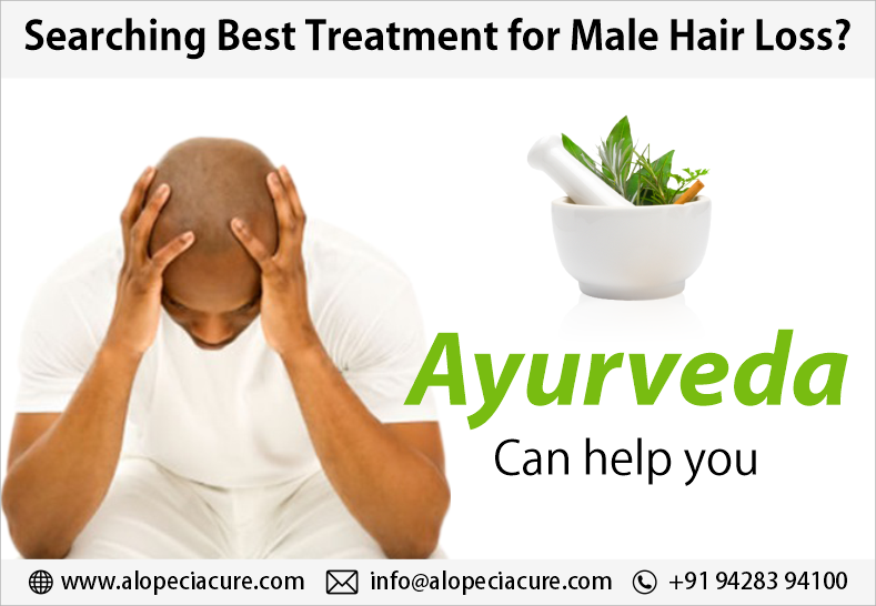 Role of DHT in Male Pattern Hair Loss